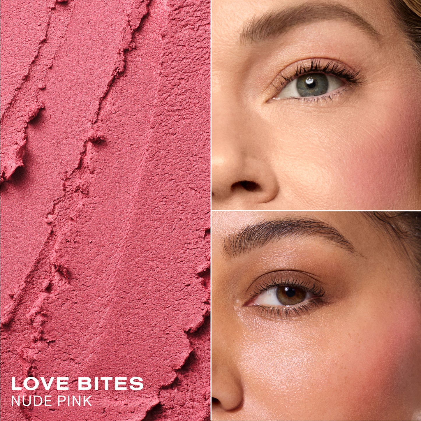 Love Bites